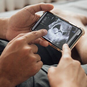 Questions to ask at your 12-week scan Questions to ask at your 12-week scan
