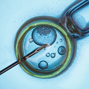 IVF Treatment: Everything You Need to Know IVF Treatment: Everything You Need to Know
