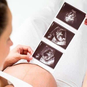 High-Risk Pregnancy Explained 