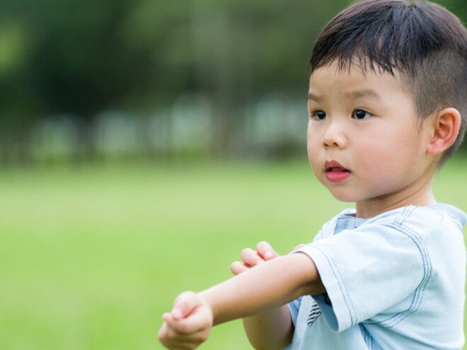 Is it possible to prevent childhood allergies? Check the symptoms of allergies here. Is it possible to prevent childhood allergies? Check the symptoms of allergies here.
