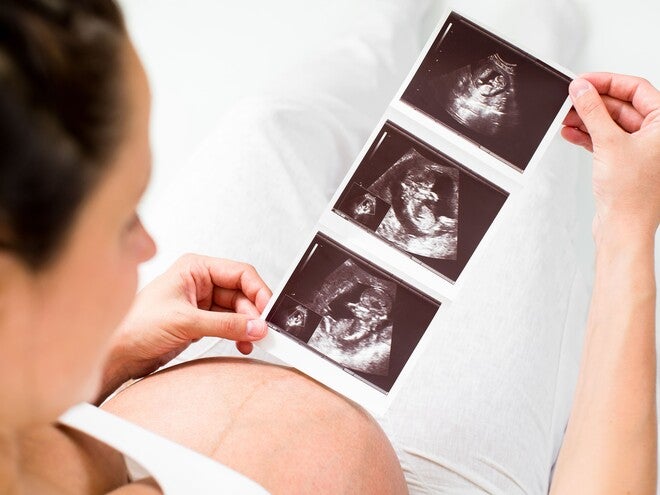 High-Risk Pregnancy Explained 